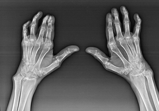 Diagnostik der Fingerverbindungen