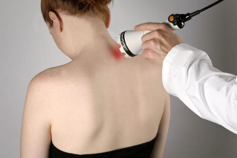 Laserbehandlung der zervikalen Osteochondrose bei Frauen